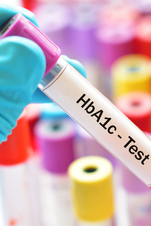 A1C Blood Sugar Test